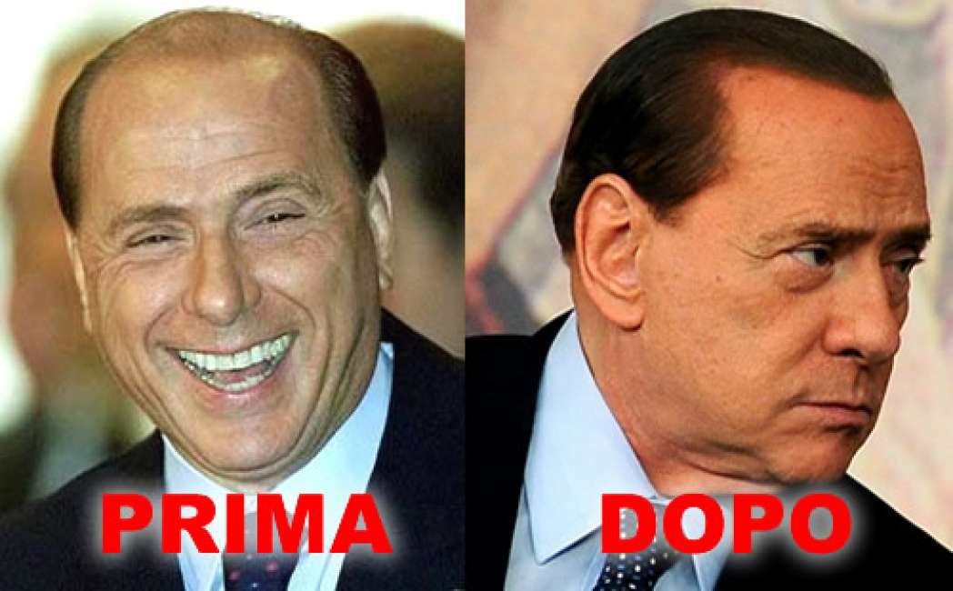 berlusconi-trapianto-capelli-831172.jpg